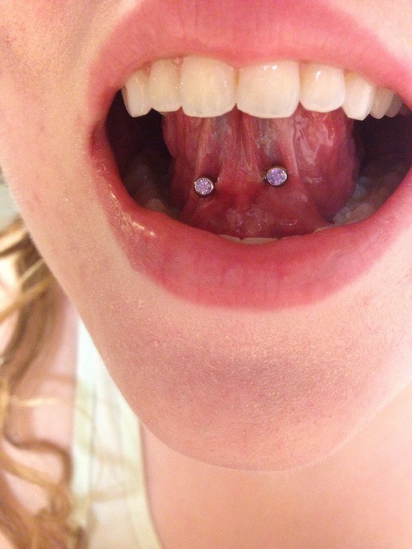Frenulum / Web